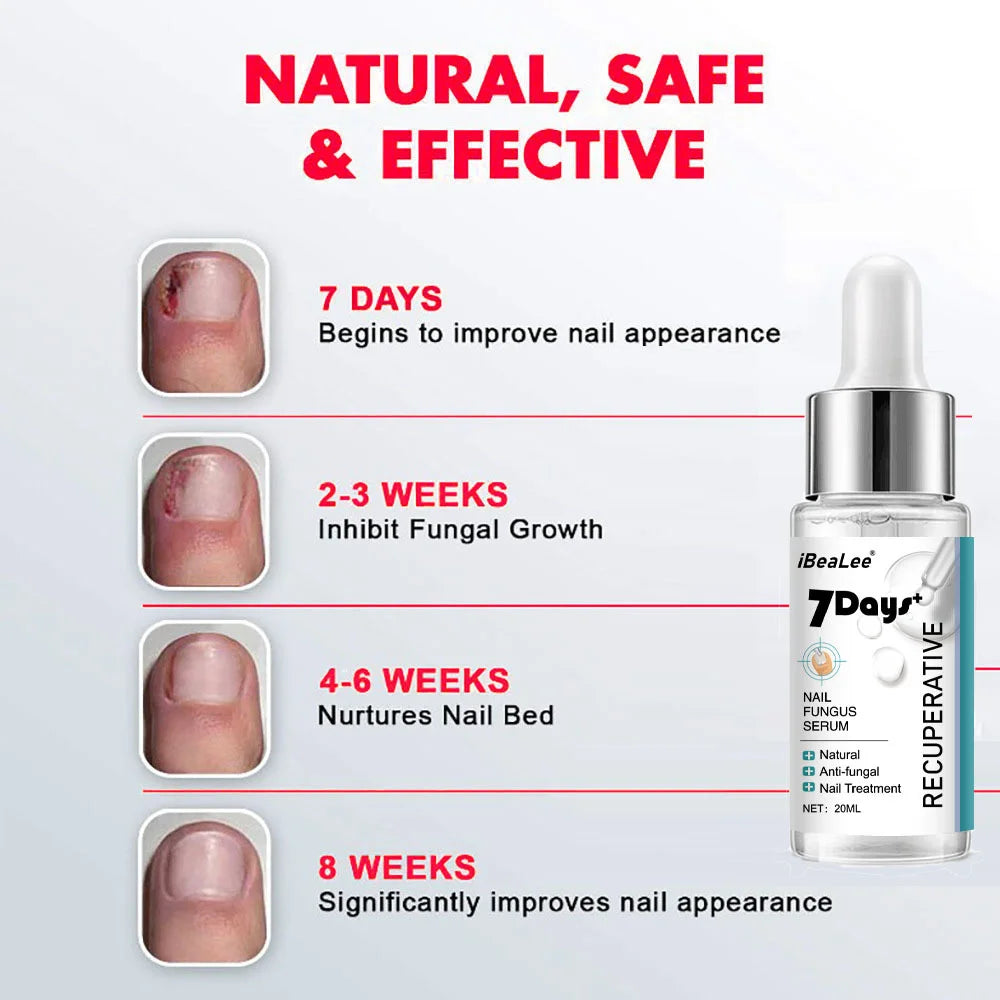 Nail Fungus Treatments Serum Anti-Infection 7DAYS Repair Foot Onychomycosis Paronychia Toe Care Nails Fungal Removal Gel  uñas