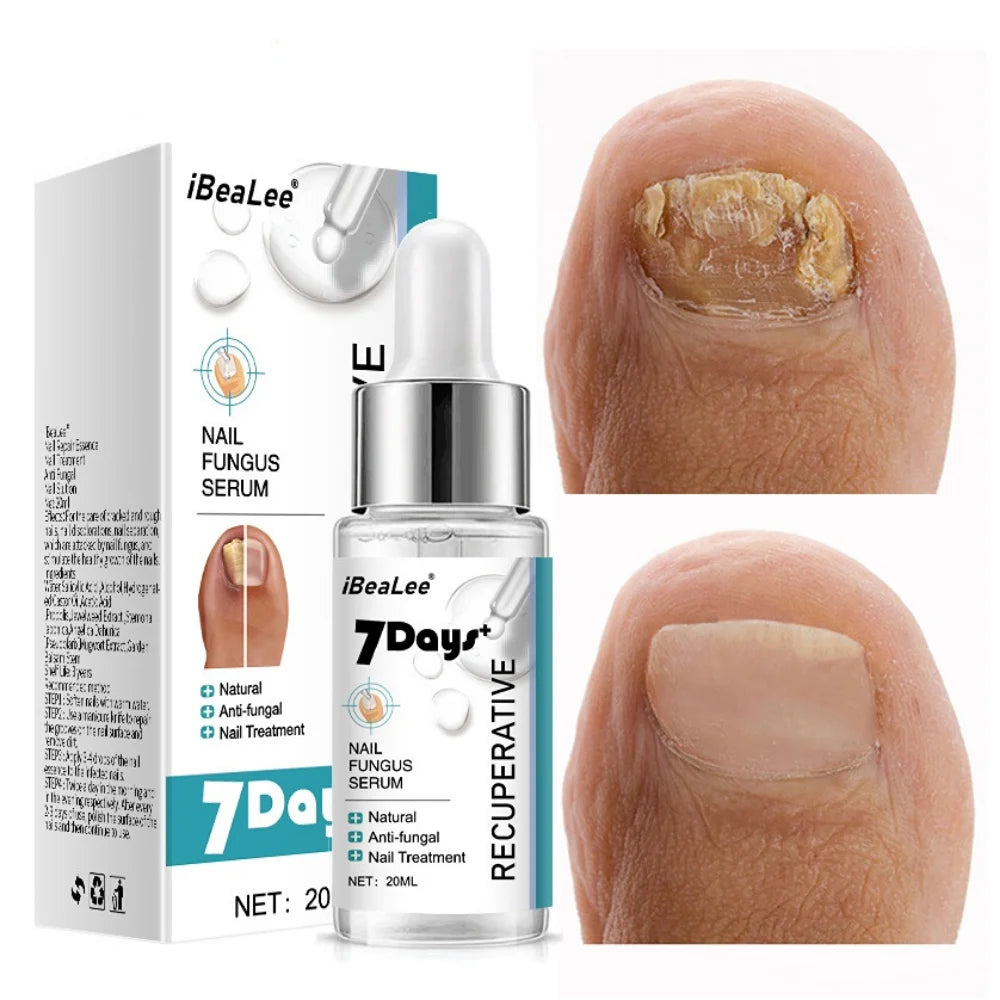 Nail Fungus Treatments Serum Anti-Infection 7DAYS Repair Foot Onychomycosis Paronychia Toe Care Nails Fungal Removal Gel  uñas