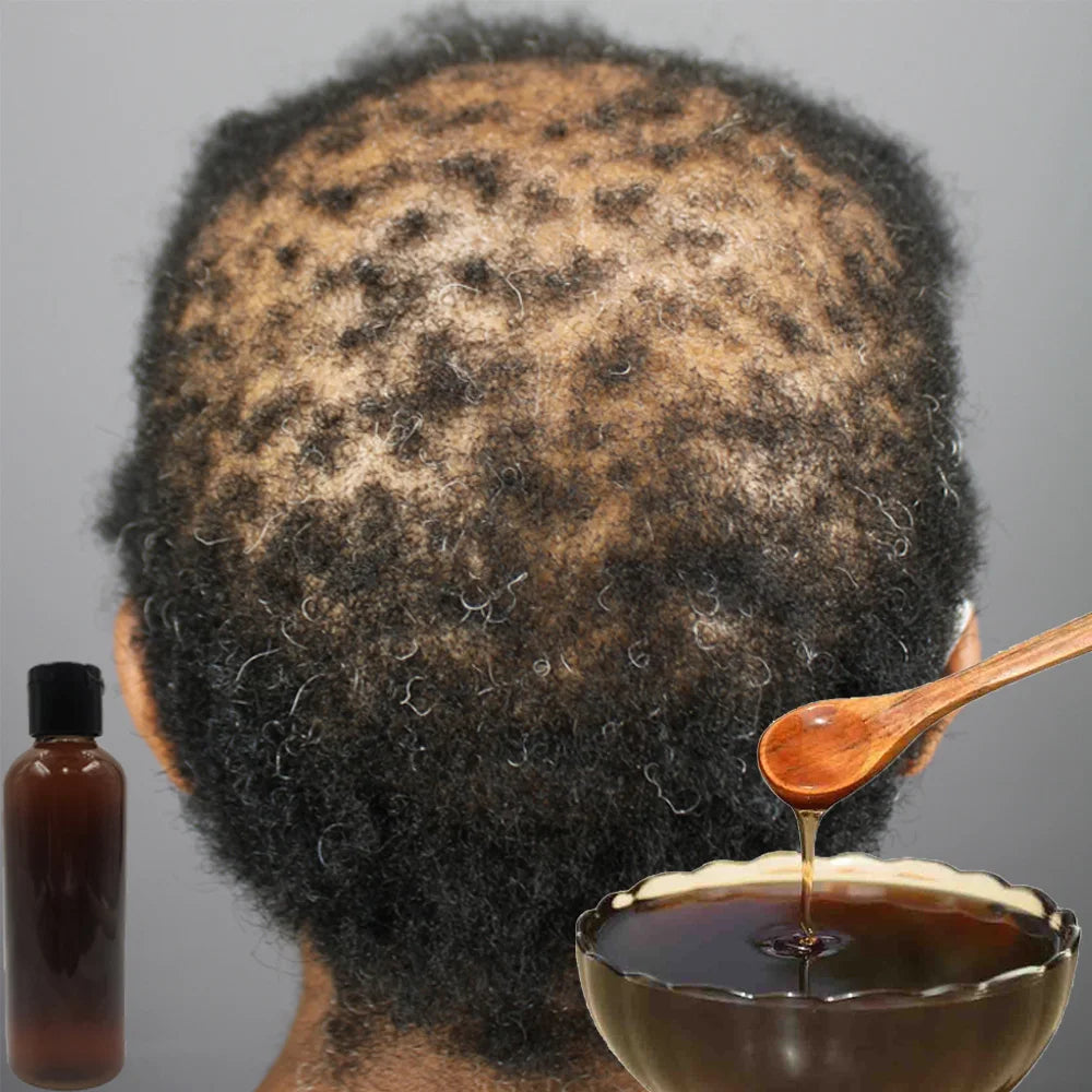 Africa Women Traction Alopecia Treatment Hair Growth Product for men Chebe Powder Shampoo Hair Loss Treatment Get Rid of Wigs