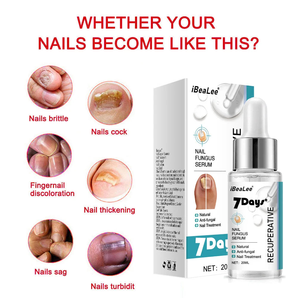 Nail Fungus Treatments Serum Anti-Infection 7DAYS Repair Foot Onychomycosis Paronychia Toe Care Nails Fungal Removal Gel  uñas